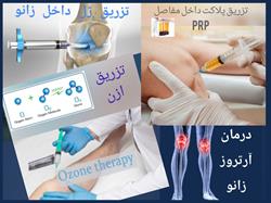 تزریقات داخل مفصلی