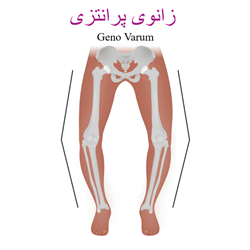 پای پرانتزی