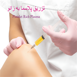 تزریق پلاسما به زانو