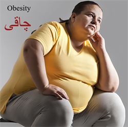 چاقی