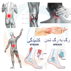 رگ به رگ شدن و کشیدگی
