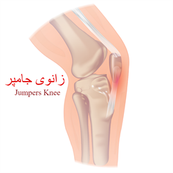 زانوی جامپر