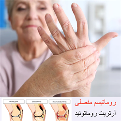 روماتیسم مفصلی