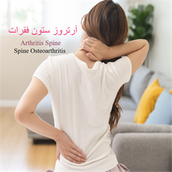 آرتروز ستون فقرات