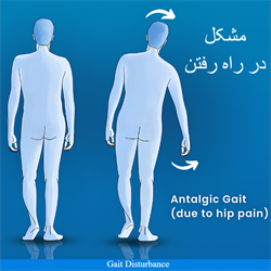 مشکل در راه رفتن